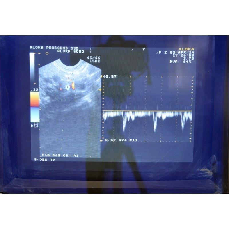 ECHOGRAPHE A VENDRE Miniature 2